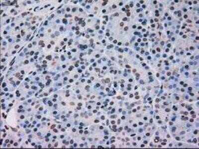 Immunohistochemistry: p38 gamma/SAPK3 Antibody (OTI10E1) - Azide and BSA Free [NBP2-73189]