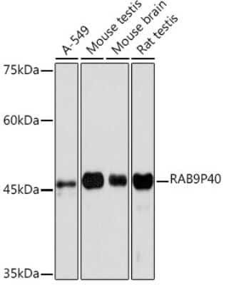 Western Blot: p40 Antibody (10E2A4) [NBP3-15815]