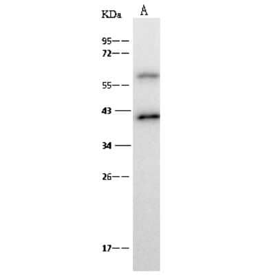 Western Blot: p40 Antibody [NBP2-99500]