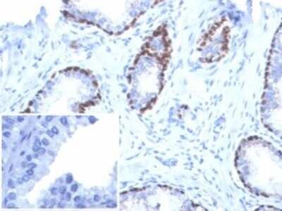 Immunohistochemistry-Paraffin: p40/deltaNp63 Antibody (P40/7302R) [NBP3-13806]
