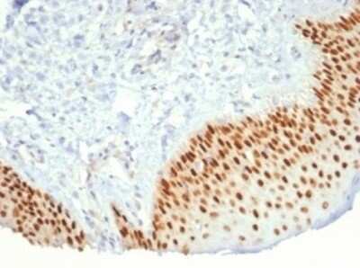 Immunohistochemistry-Paraffin: p40/deltaNp63 Antibody (P40/7302R) [NBP3-13806]