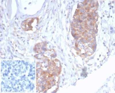Immunohistochemistry-Paraffin: p40/deltaNp63 Antibody (P40/7302R) [NBP3-13806]