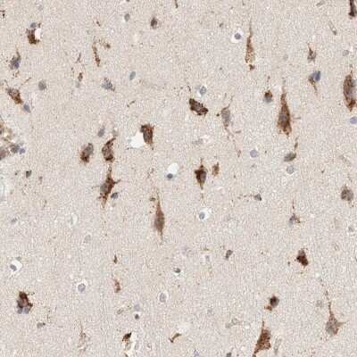 Immunohistochemistry-Paraffin: p40 Antibody [NBP1-88737]