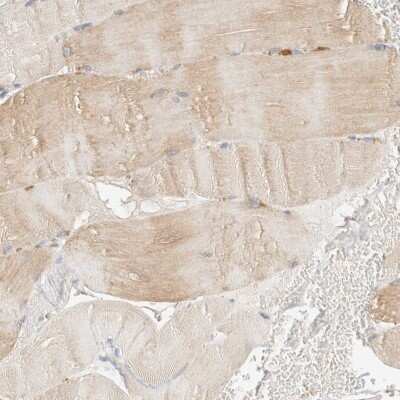 Immunohistochemistry-Paraffin: p40 Antibody [NBP1-88737]