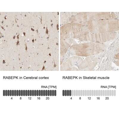 Immunohistochemistry-Paraffin: p40 Antibody [NBP1-88737]