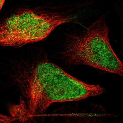 Immunocytochemistry/ Immunofluorescence: p400 Antibody [NBP1-88230]