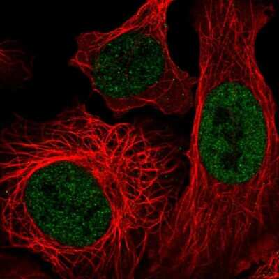 Immunocytochemistry/ Immunofluorescence: p400 Antibody [NBP2-55019]