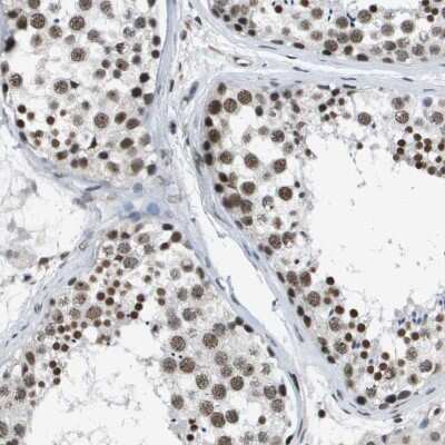 Immunohistochemistry-Paraffin: p400 Antibody [NBP1-88230]