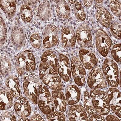 Immunohistochemistry-Paraffin: p53 AIP1 Antibody [NBP2-13465]