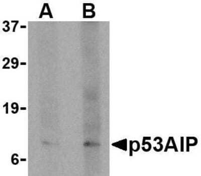 Western Blot: p53 AIP1 AntibodyBSA Free [NBP1-76742]