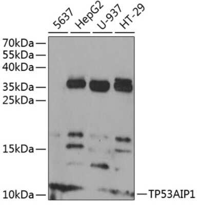 Western Blot: p53 AIP1 AntibodyBSA Free [NBP2-94841]