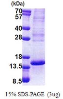 SDS-PAGE: Recombinant Human p53 AIP1 His Protein [NBP2-22909]