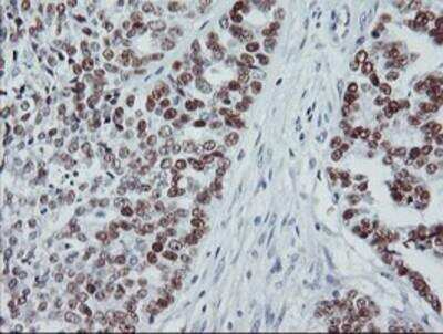 Immunohistochemistry-Paraffin: p53 Antibody (OTI5E2) [NBP2-00723]