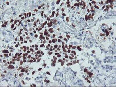 Immunohistochemistry-Paraffin: p53 Antibody (OTI5E2) [NBP2-00723]