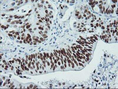 Immunohistochemistry-Paraffin: p53 Antibody (OTI5E2) [NBP2-00723]