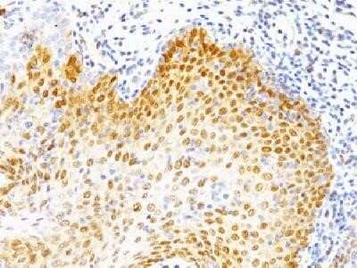 Immunohistochemistry-Paraffin: p53 Antibody (BP53-12 + DO-7) - Azide and BSA Free [NBP2-34563]