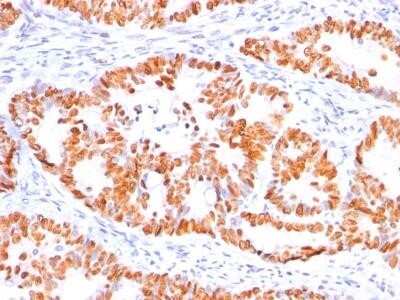 Immunohistochemistry-Paraffin: p53 Antibody (BP53-12) - IHC-Prediluted [NBP2-44976]