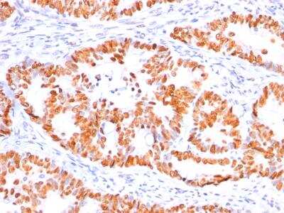 Immunohistochemistry-Paraffin: p53 Antibody (BP53-12) [NBP2-29453]