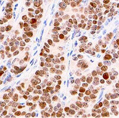 Immunohistochemistry-Paraffin: p53 Antibody (BP53-12) [NBP2-29453]