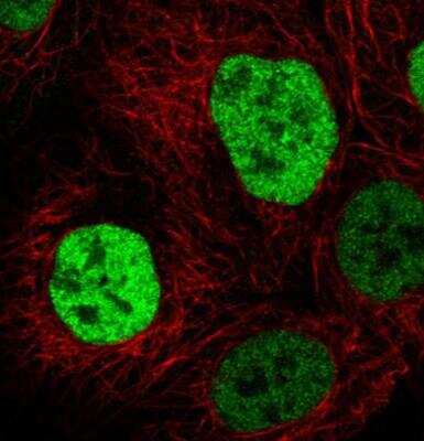 Immunocytochemistry/ Immunofluorescence: p53 Antibody (CL2199) [NBP2-34495]