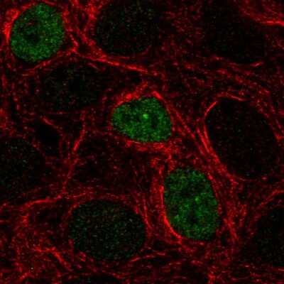 Immunocytochemistry/ Immunofluorescence: p53 Antibody (CL2199) [NBP2-34495]