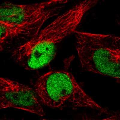 Immunocytochemistry/ Immunofluorescence: p53 Antibody (CL2199) [NBP2-34495]