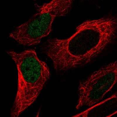 Immunocytochemistry/ Immunofluorescence: p53 Antibody (CL2199) [NBP2-34495]