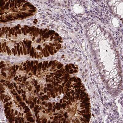 Immunohistochemistry-Paraffin: p53 Antibody (CL2199) [NBP2-34495]