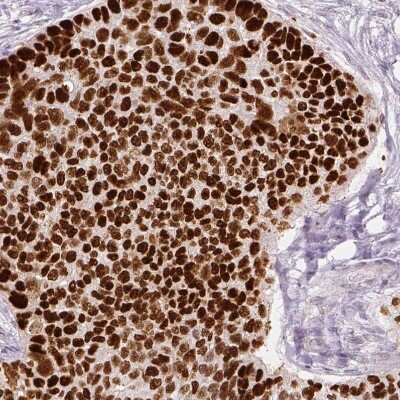 Immunohistochemistry-Paraffin: p53 Antibody (CL2199) [NBP2-34495]
