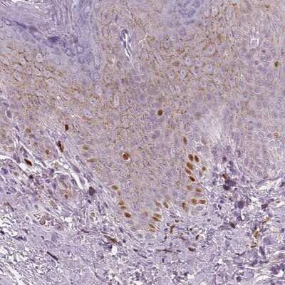Immunohistochemistry-Paraffin: p53 Antibody (CL2199) [NBP2-34495]