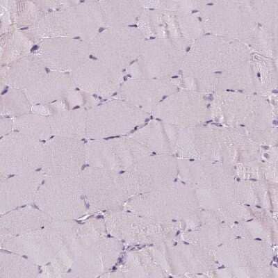 Immunohistochemistry-Paraffin: p53 Antibody (CL2199) [NBP2-34495]
