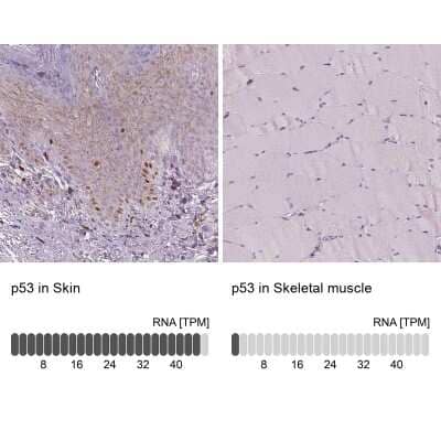 Immunohistochemistry-Paraffin: p53 Antibody (CL2199) [NBP2-34495]