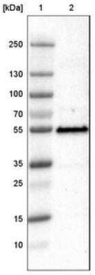 Western Blot: p53 Antibody (CL2199) [NBP2-34495]