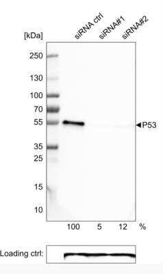 Western Blot: p53 Antibody (CL2199) [NBP2-34495]