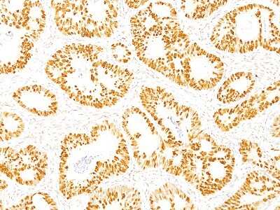 Immunohistochemistry-Paraffin: p53 Antibody (DO-7) - Azide and BSA Free [NBP2-34605]