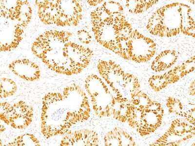 Immunohistochemistry-Paraffin: p53 Antibody (DO-7) [NBP2-34308]