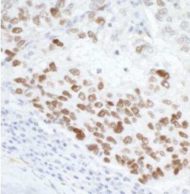 Immunohistochemistry-Paraffin: p53 Antibody [NB200-171]