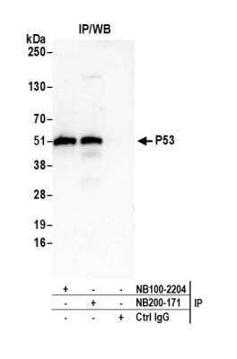 Immunoprecipitation: p53 Antibody [NB200-171]