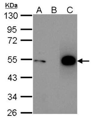 Immunoprecipitation: p53 Antibody [NBP2-19667]