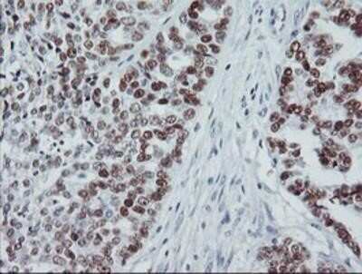 Immunohistochemistry: p53 Antibody (OTI5E2) - Azide and BSA Free [NBP2-73200]