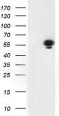 Western Blot: p53 Antibody (OTI5E2)Azide and BSA Free [NBP2-73200]