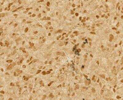 Immunohistochemistry-Paraffin: p53 Antibody (Pab1801) [NB200-104]