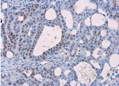 Immunohistochemistry-Paraffin: p53 Antibody (Pab1801) [NB200-104]