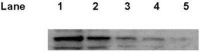 Western Blot: p53 Antibody (Pab1801) [NB200-104]