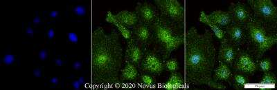 Immunocytochemistry/ Immunofluorescence: p53 Antibody (PAb 240) - BSA Free [NB200-103]