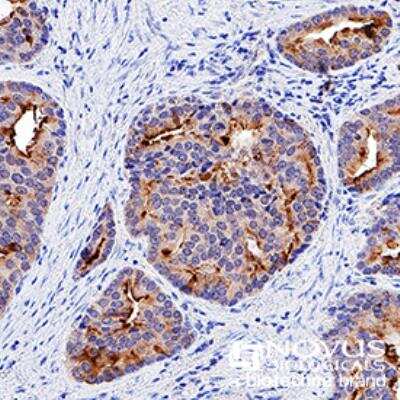 Immunohistochemistry-Paraffin: p53 Antibody (PAb 240) - BSA Free [NB200-103]