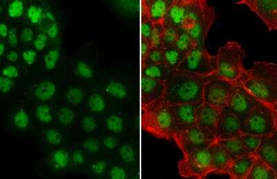 Immunocytochemistry/ Immunofluorescence: p53 Antibody (Pab1801) [NB200-104]