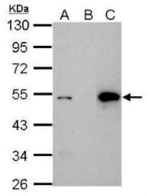 Immunoprecipitation: p53 Antibody (Pab1801) [NB200-104]
