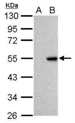 Western Blot: p53 Antibody (Pab1801) [NB200-104]