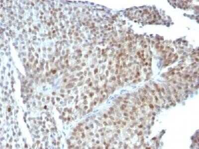 Immunohistochemistry-Paraffin: p53 Antibody (SPM589) - Azide and BSA Free [NBP2-34817]